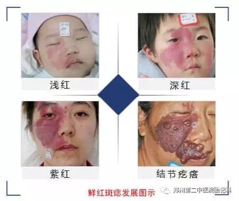 广州健肤皮肤专科门诊部：守护肌肤健康的新选择